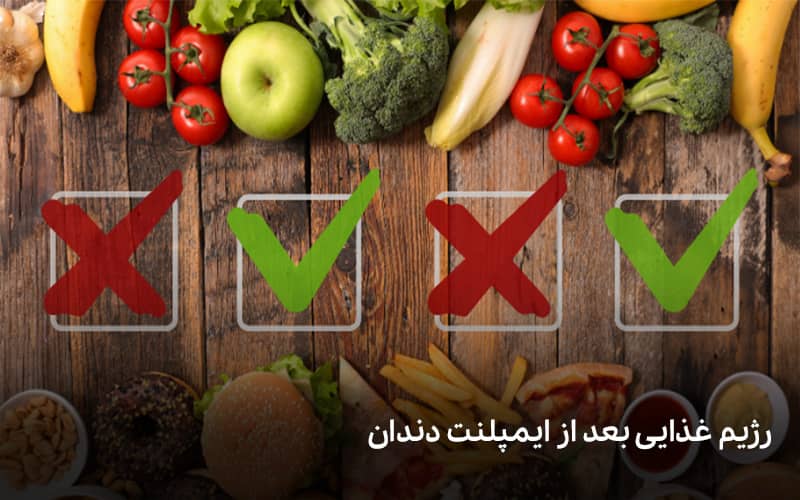 اهمیت رژیم غذایی بعد از ایمپلنت دندان