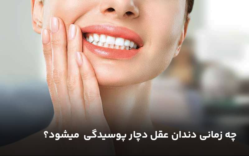 چه زمانی دندان عقل دچار پوسیدگی  میشود؟