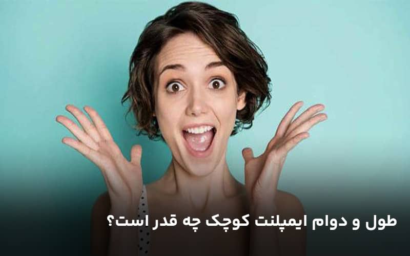 طول و دوام ایمپلنت کوچک چه قدر است؟