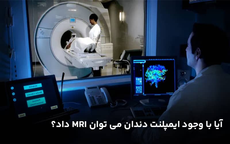 آیا با وجود ایمپلنت دندان می توان MRI داد؟