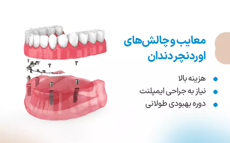 معایب و چالش‌های اورنچر دندان
