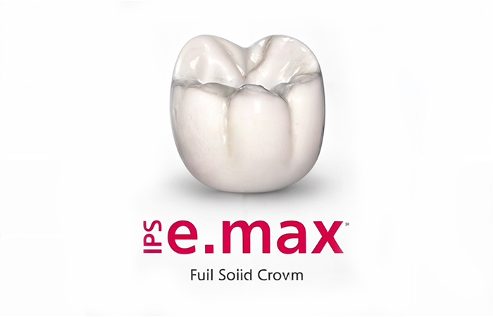 روکش دندان EMAX