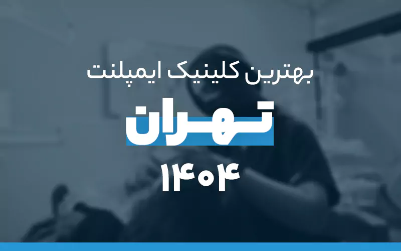 بهترین کلینیکهای ایمپلنت در تهران